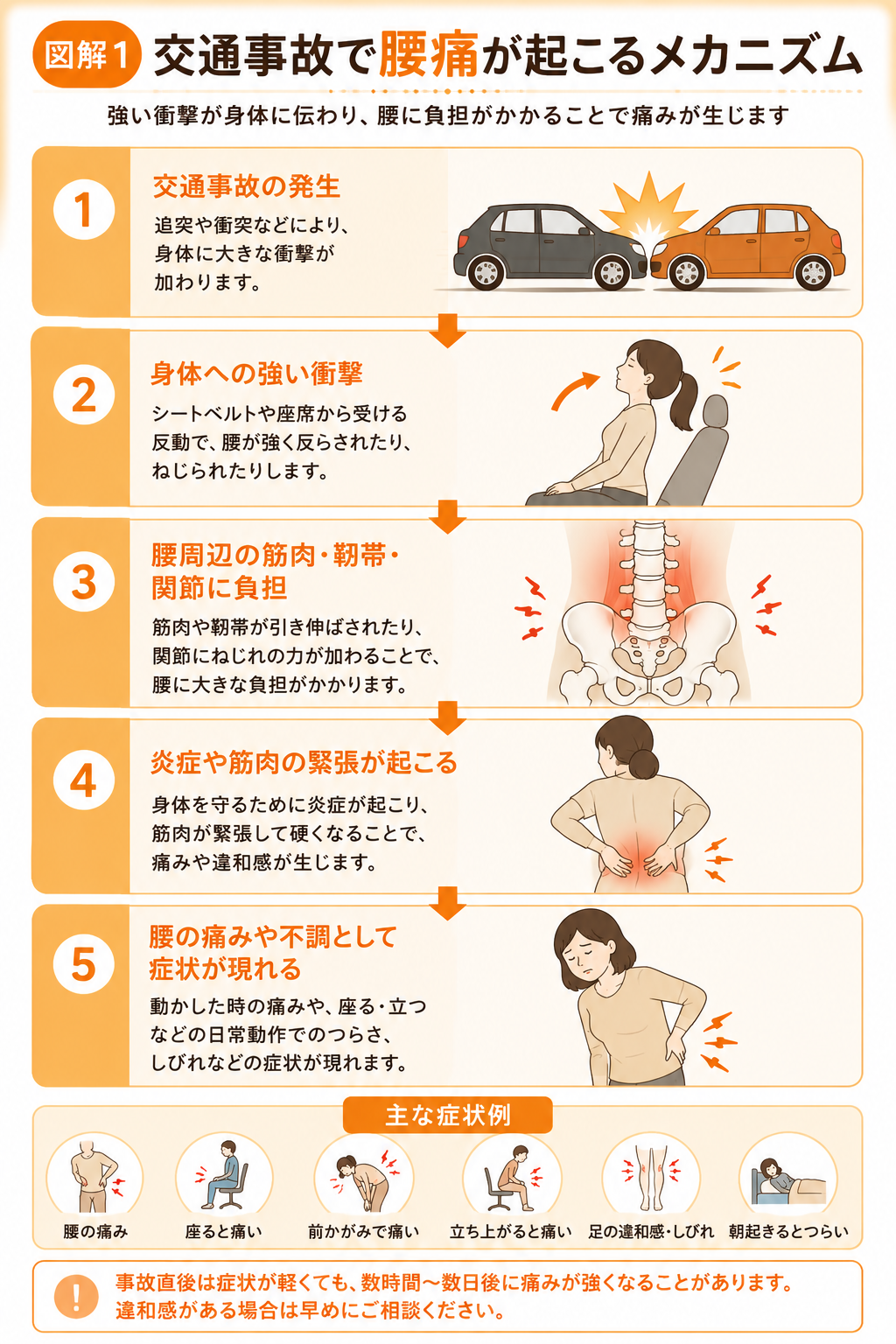 交通事故で腰痛が起こるメカニズムを解説した図